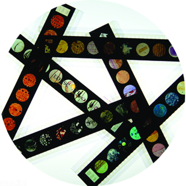 Microslide Human Diseases